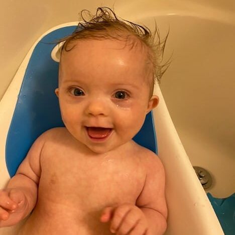 happy baby with Down syndrome