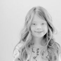 Black and white photo of a young girl with Down syndrome