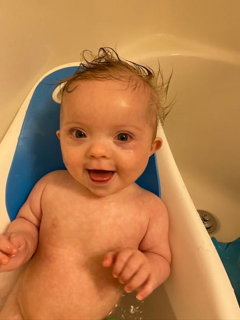 happy baby with Down syndrome