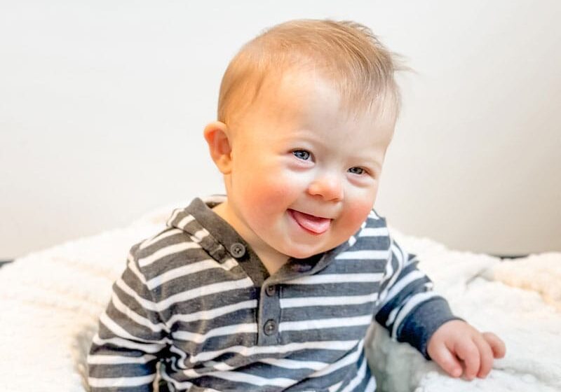 Cute baby with Down syndrome sitting and smiling