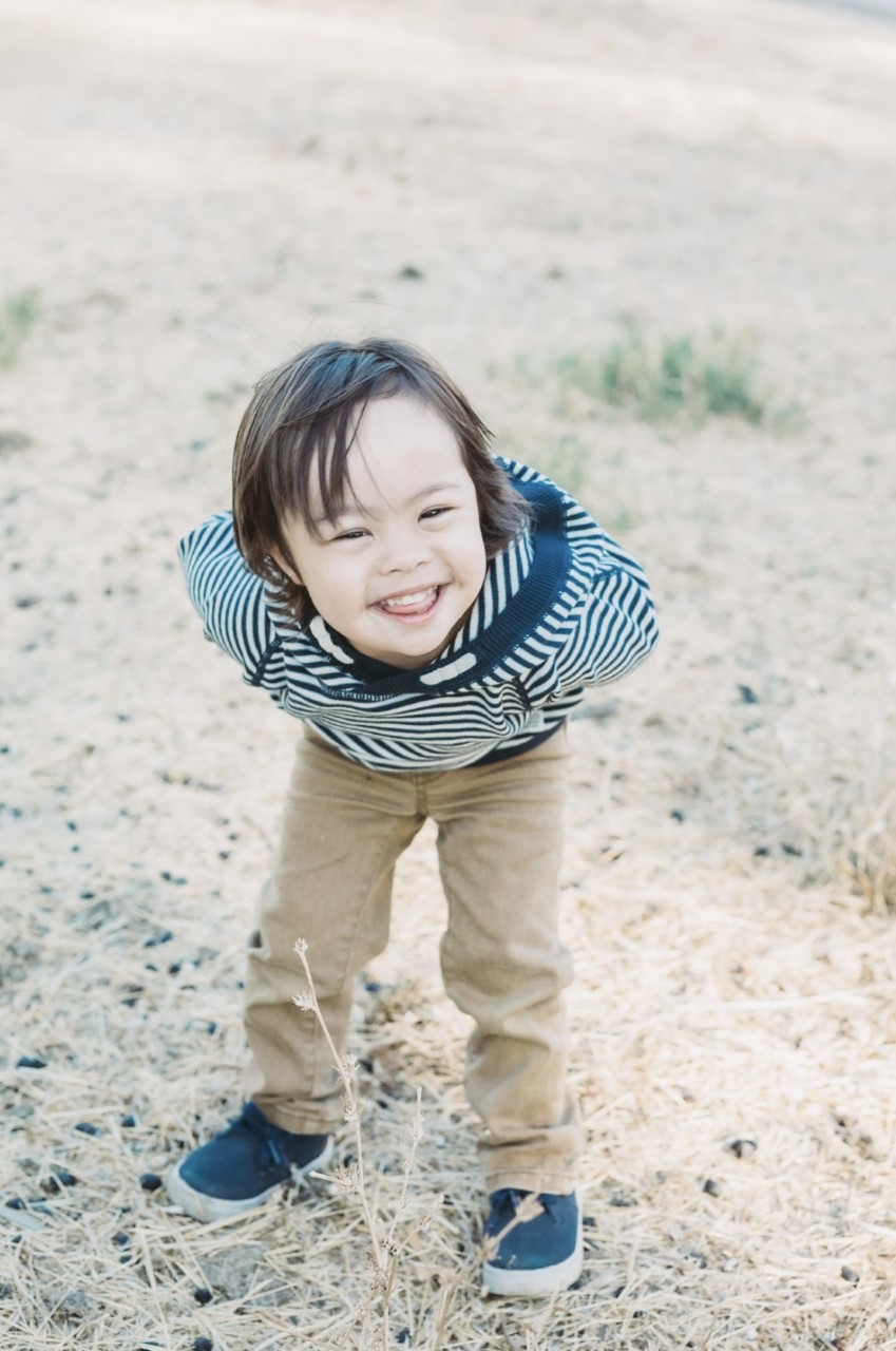 Picture of a little boy with Down syndrome