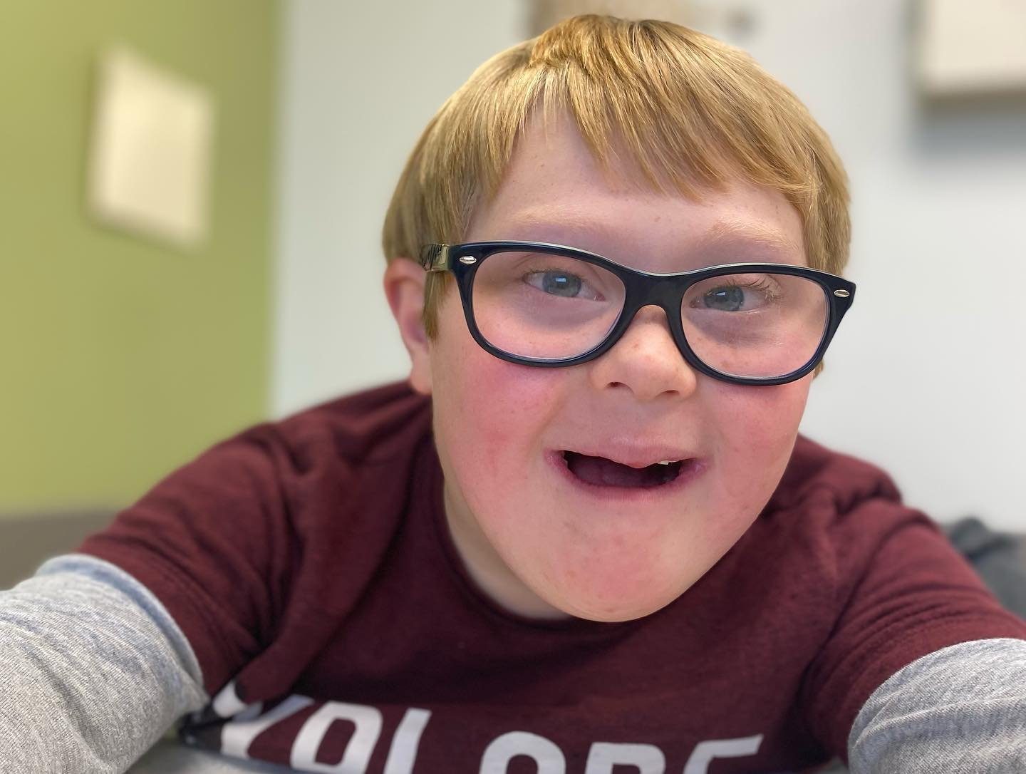 Little boy with Down syndrome wearing glasses and smiling
