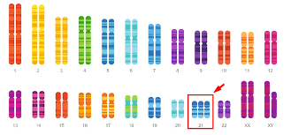 Down syndrome chromosome