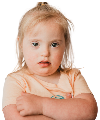 image of a girl with down syndrome